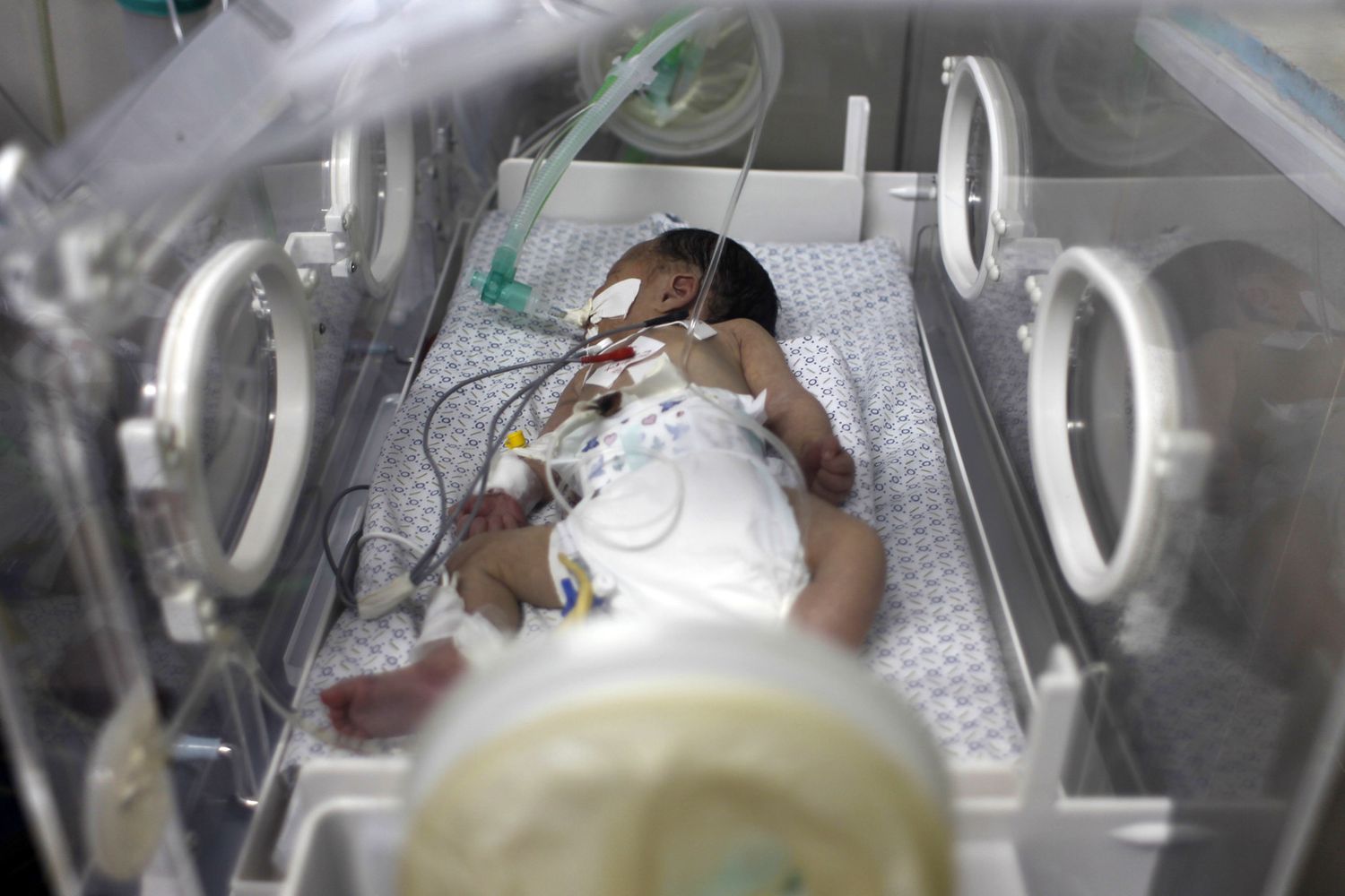 &nbsp;Bambino in un'incubatrice