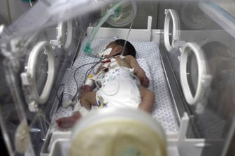 &nbsp;Bambino in un'incubatrice