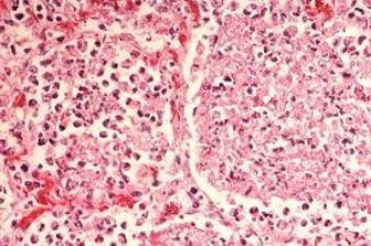 &nbsp;batterio della legionella