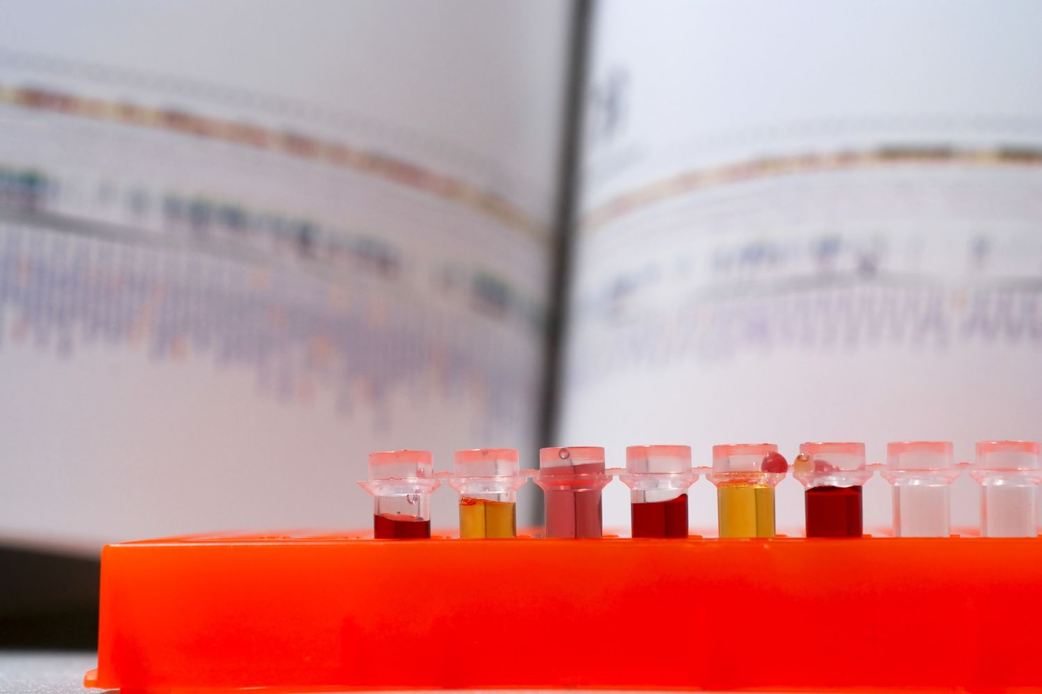 Genetica (Afp)&nbsp;