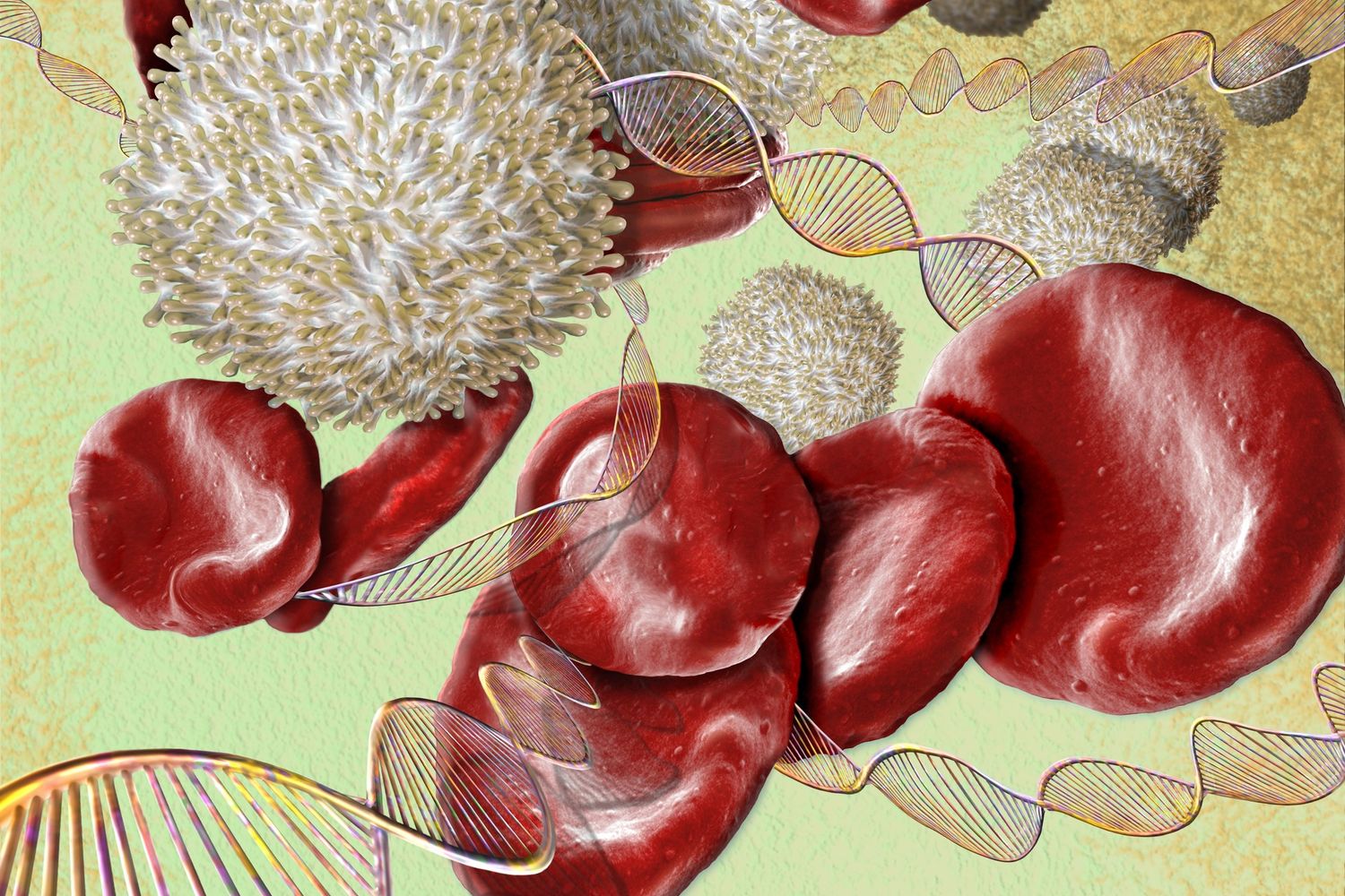 &nbsp;Tumori del sangue