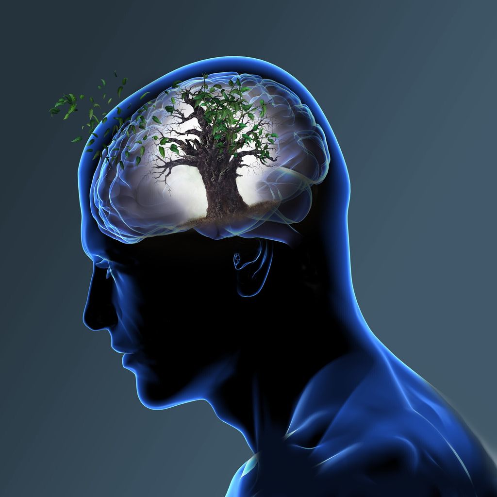 &nbsp;Cervello Alzheimer