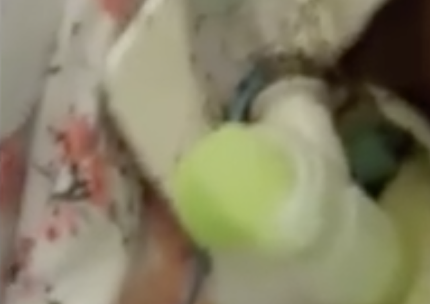 &nbsp;Uno screenshot del video della donna coperta di formiche in un ospedale di Napoli