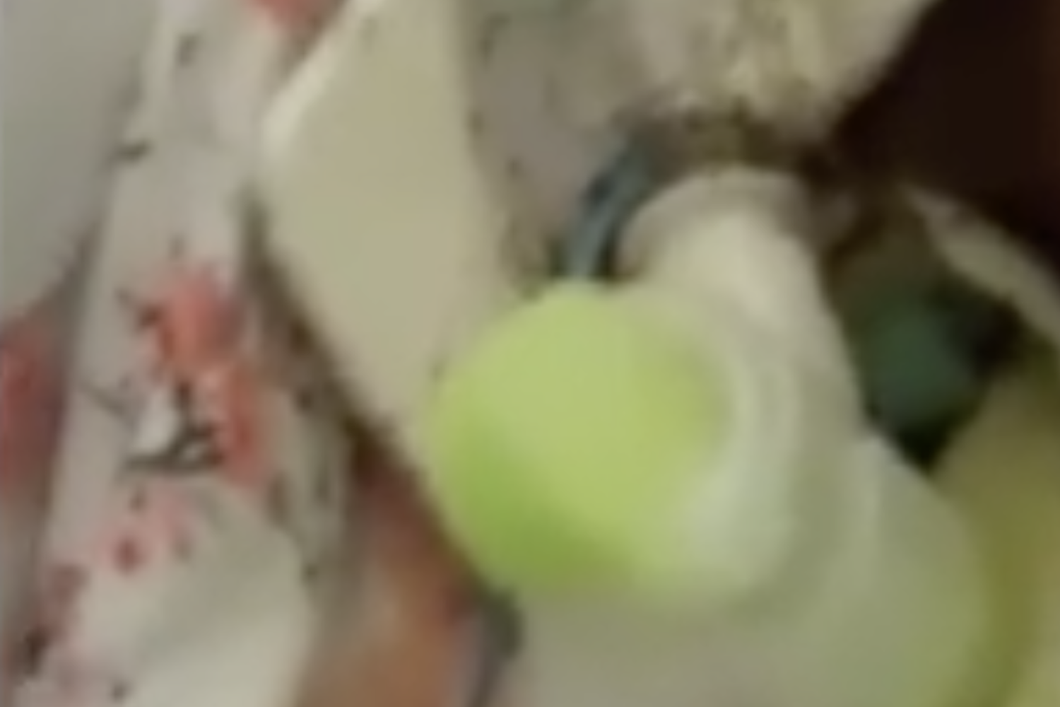 &nbsp;Uno screenshot del video della donna coperta di formiche in un ospedale di Napoli