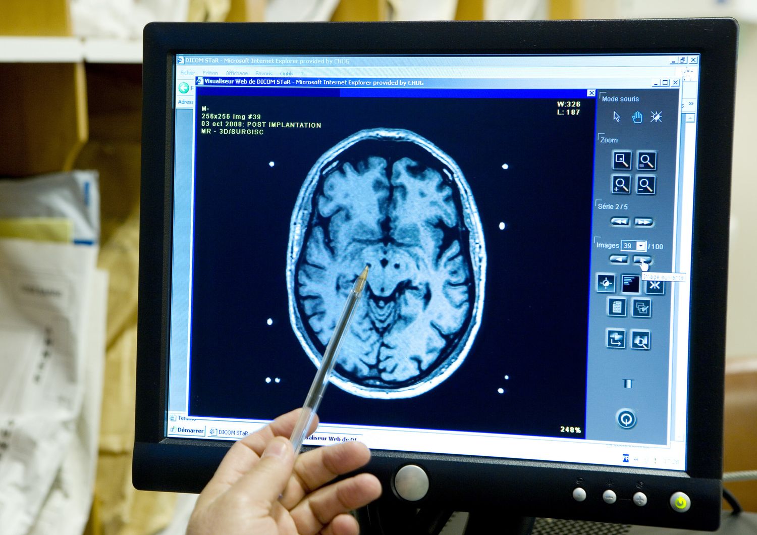 Una radiografia di un cervello&nbsp;