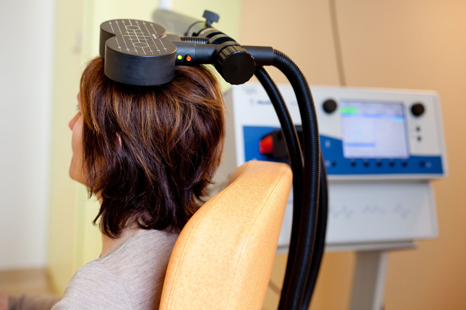 Transcranial magnetic stimulation (TMS), Dipartimento di Psichiatria al Piti&eacute;-Salp&ecirc;tri&egrave;re hospital, in Francia