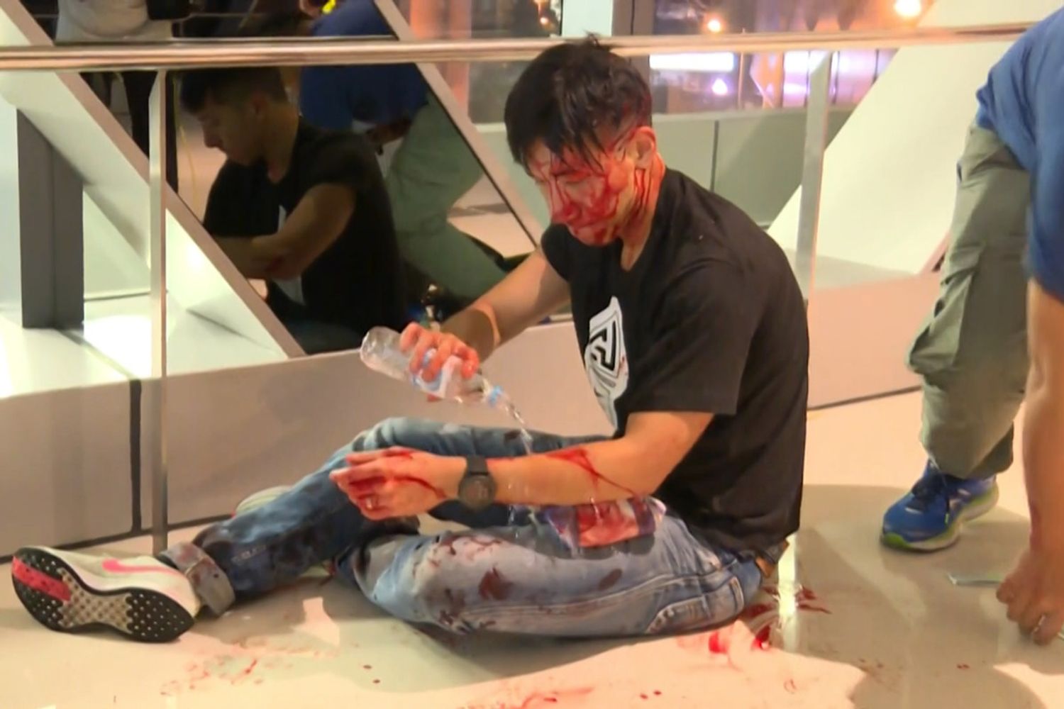 Uno dei feriti durante l'attacco alla stazione di Hong Kong&nbsp;