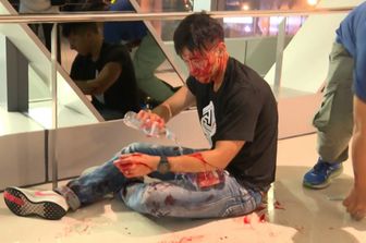 Uno dei feriti durante l'attacco alla stazione di Hong Kong&nbsp;