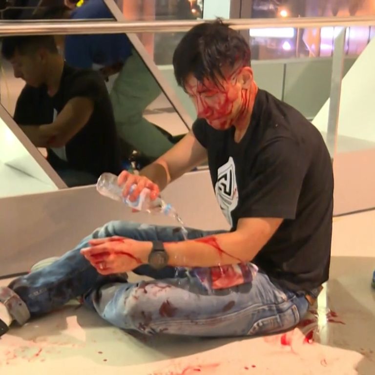 Uno dei feriti durante l'attacco alla stazione di Hong Kong&nbsp;