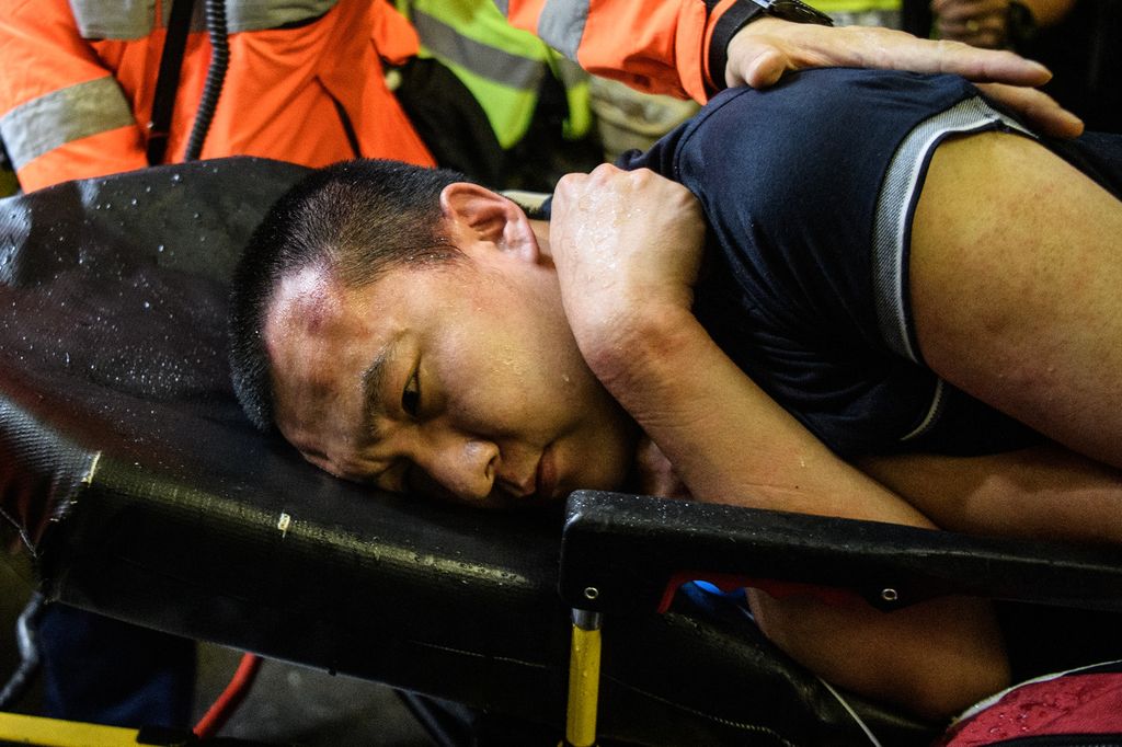 Ferito durante le violenze a Hong Kong