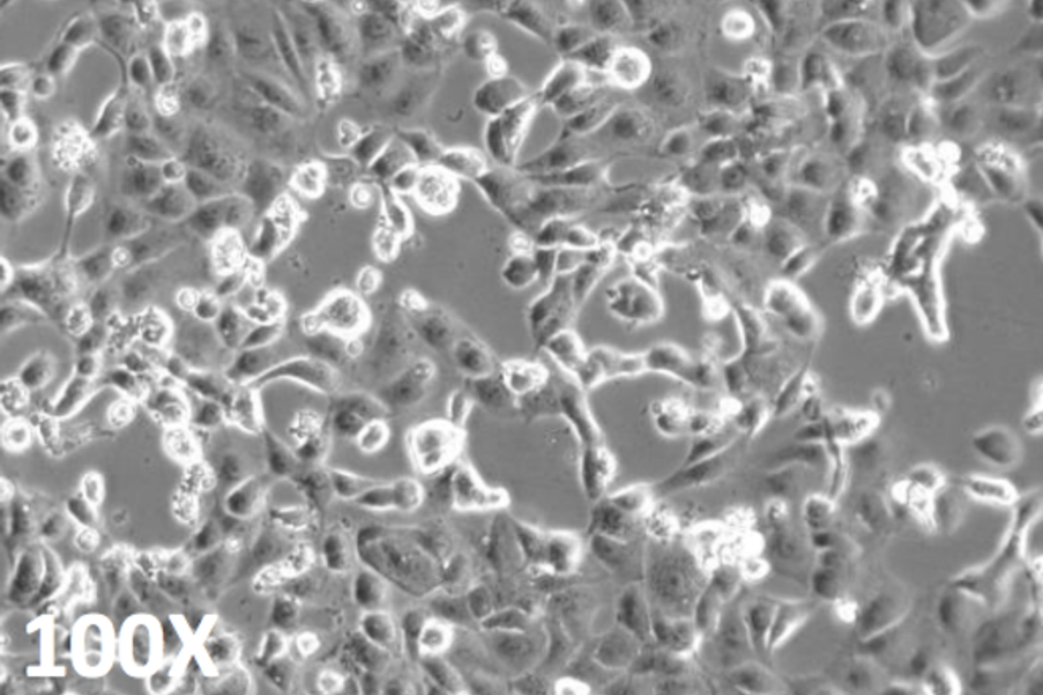 Il coronavirus isolato dallo Spallanzani