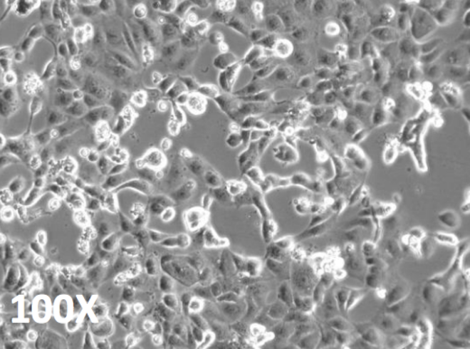 Il coronavirus isolato dallo Spallanzani