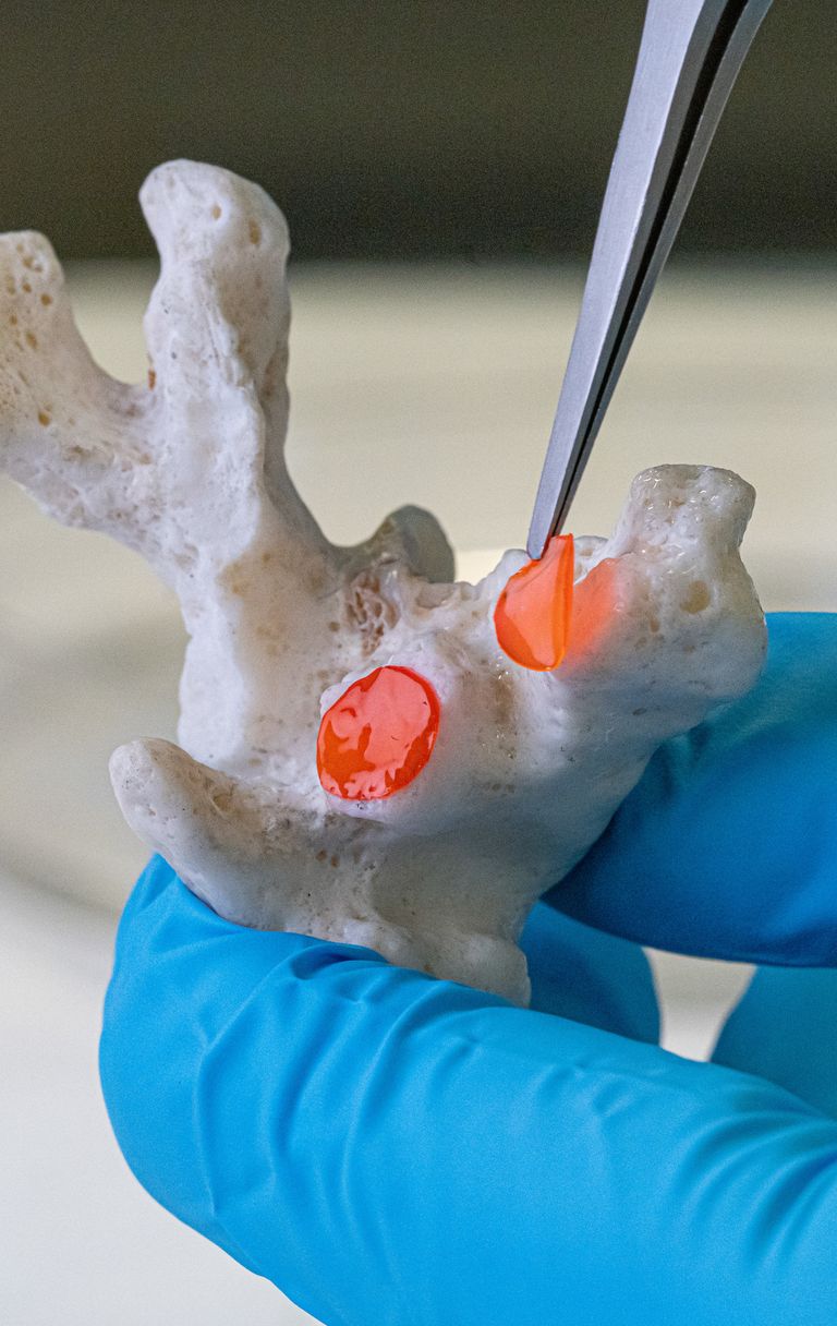 Il cerotto per coralli