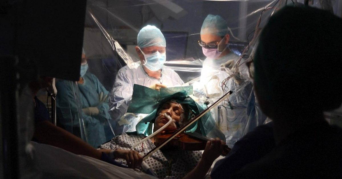 Suona il violino mentre la operano al cervello e salva la sua arte