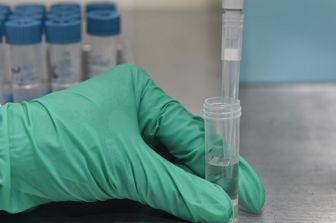 Analisi di laboratorio