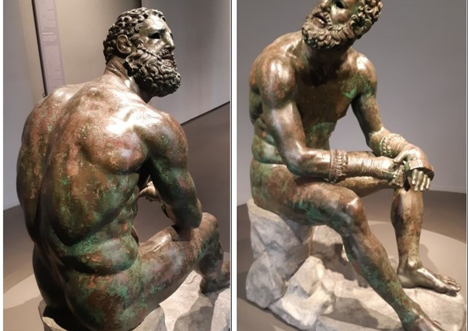 &nbsp; &nbsp;Il Pugilatore  al Museo Nazionale Romano
