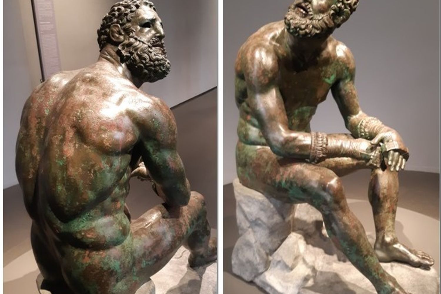 &nbsp; &nbsp;Il Pugilatore  al Museo Nazionale Romano