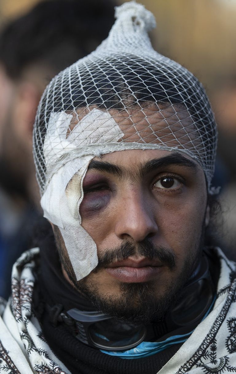 Respingere, a tutti i costi