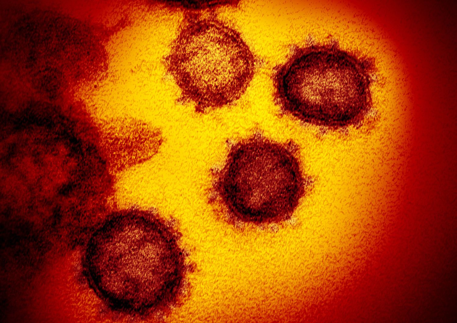 Il coronavirus COVID-19 visto al microscopio elettronico, isolato da un paziente, emerge dalla superficie di cellule coltivate in laboratorio&nbsp;