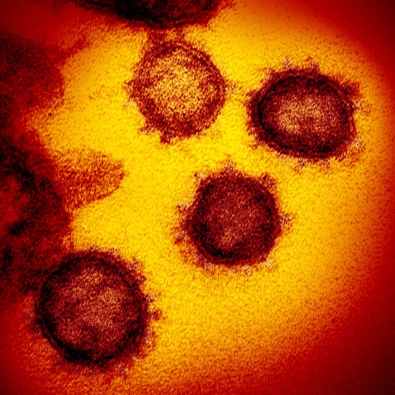 Il coronavirus COVID-19 visto al microscopio elettronico, isolato da un paziente, emerge dalla superficie di cellule coltivate in laboratorio&nbsp;