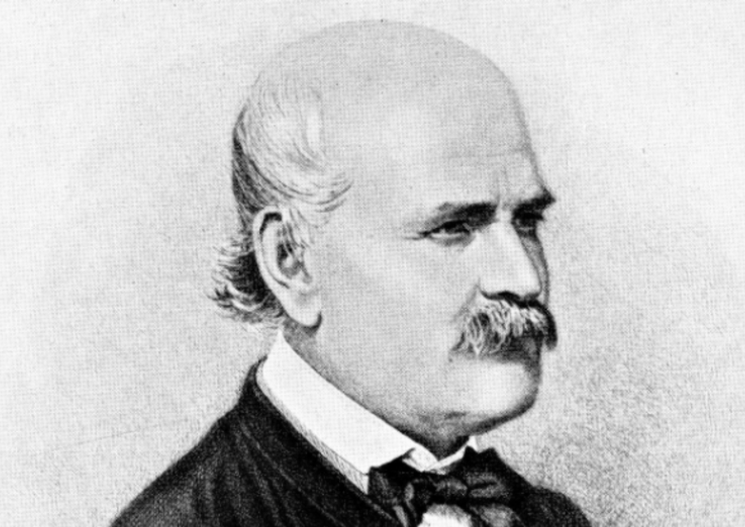 lavarsi mani coronavirus&nbsp;semmelweis