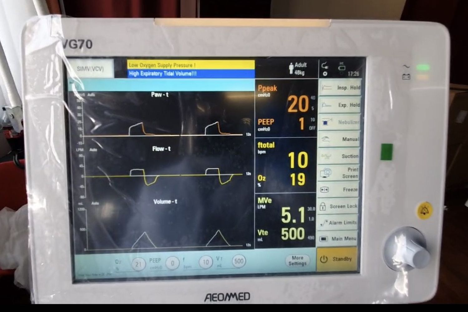 Uno dei respiratori donati da Zte all'Italia