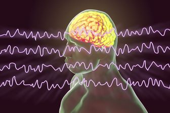 Illustrazione di un elettroencefalogramma