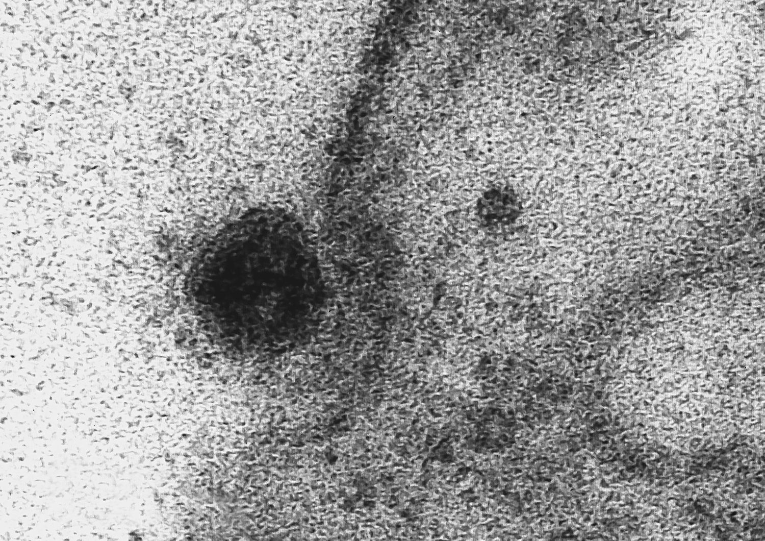 Un immagine del coronavirus Covid-19 che infetta una cellula