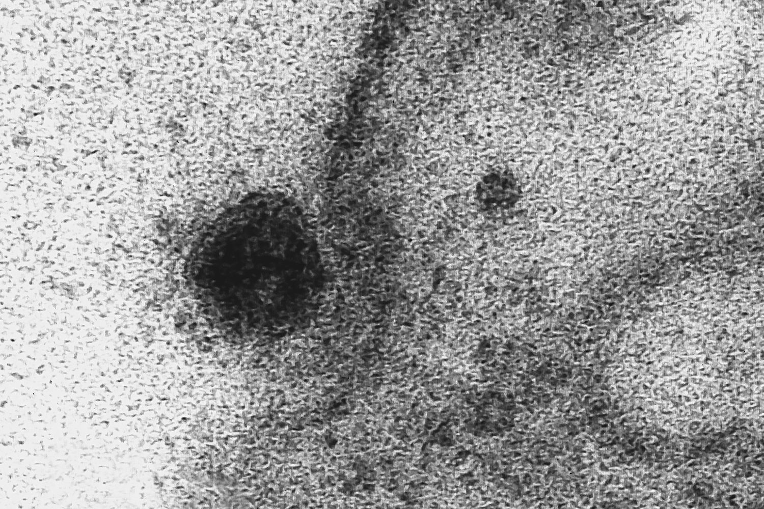 Un immagine del coronavirus Covid-19 che infetta una cellula
