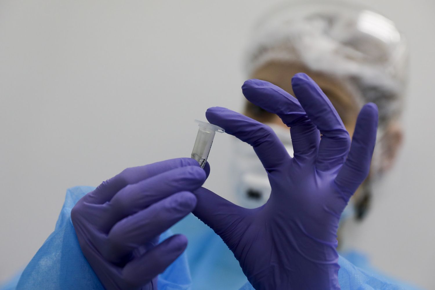 Esami di laboratorio sul coronavirus