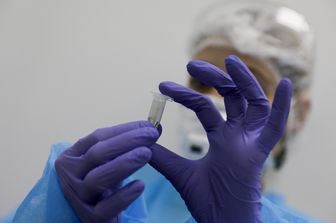 Esami di laboratorio sul coronavirus