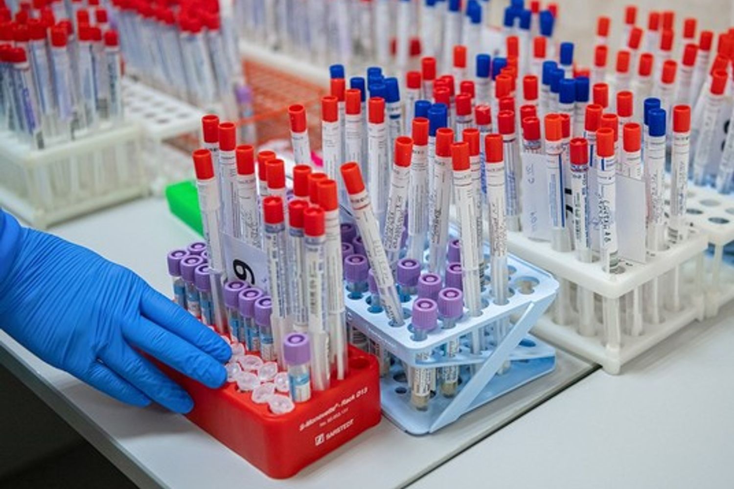 Analisi di laboratorio sul coronavirus