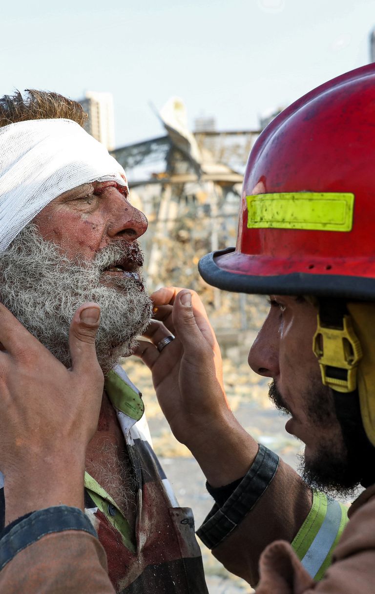 Feriti durante esplosione a Beirut, Libano