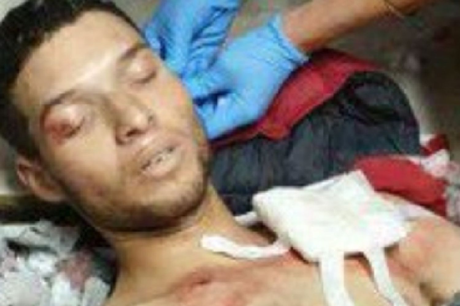 Nella foto il killer di Nizza, Brahim Aoussaoui, in ospedale dopo la sua cattura (foto dal sito di Al Arabiya)