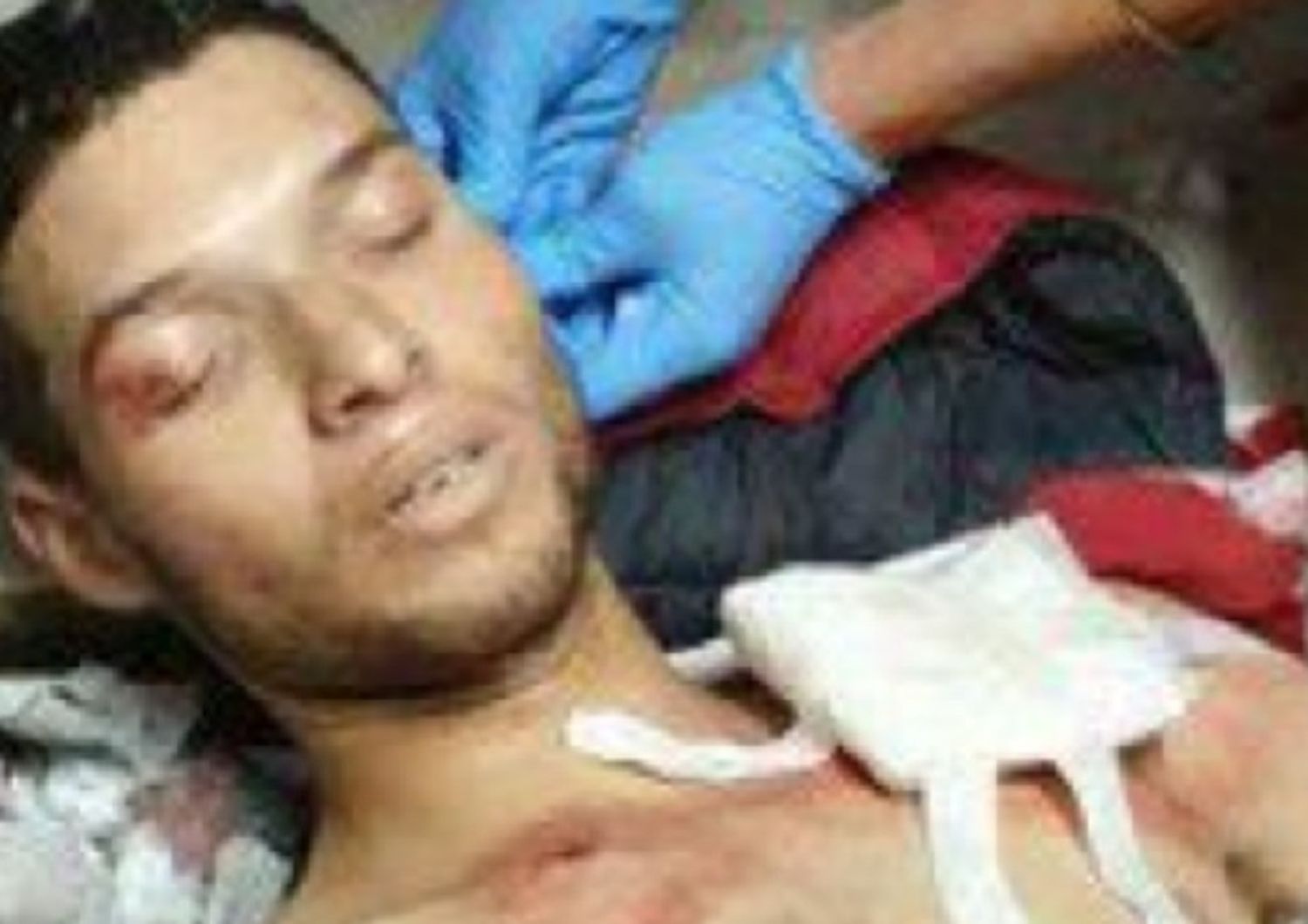 Nella foto il killer di Nizza, Brahim Aoussaoui, in ospedale dopo la sua cattura (foto dal sito di Al Arabiya)