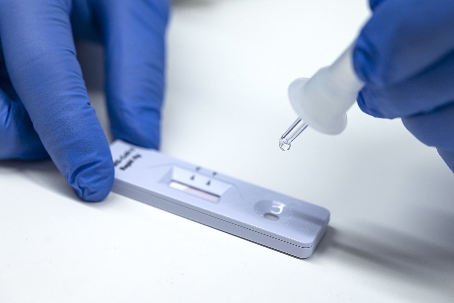 Test antigenico rapido