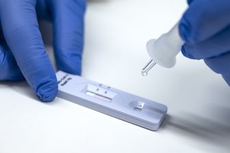 Test antigenico rapido