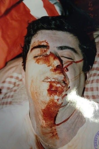 Il cadavere di Attilio Manca