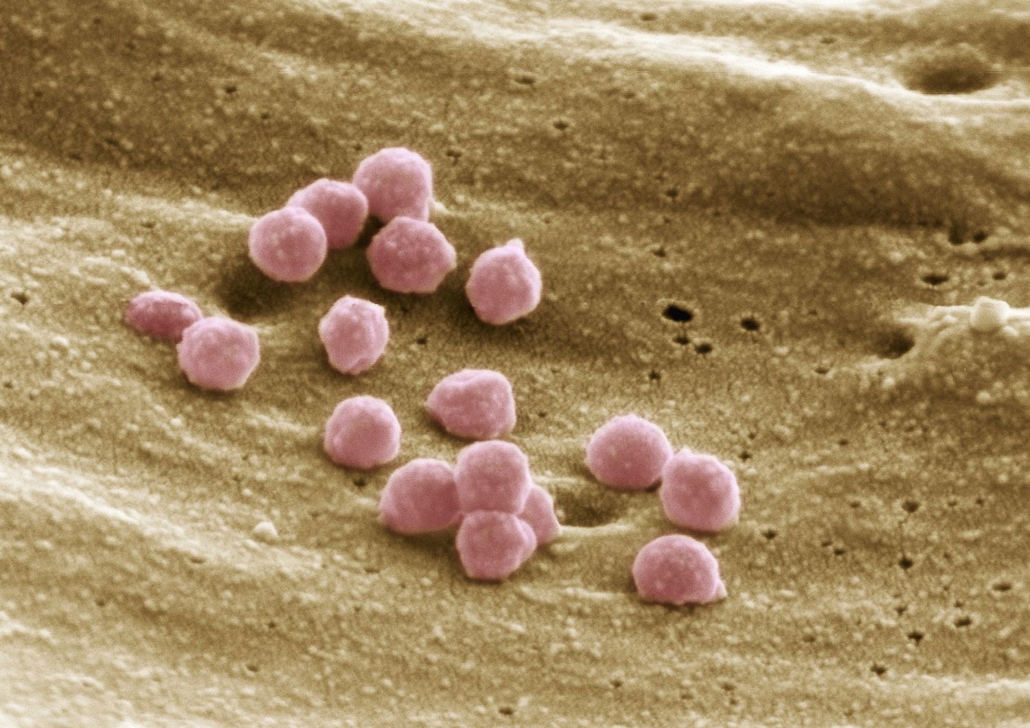 Aids: particelle del virus Hiv ingrandite al microscopio elettronico