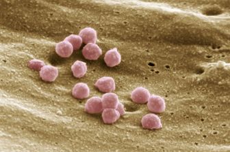 Aids: particelle del virus Hiv ingrandite al microscopio elettronico