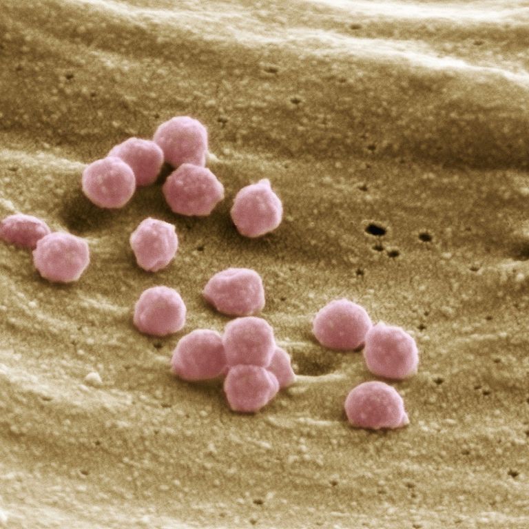 Aids: particelle del virus Hiv ingrandite al microscopio elettronico