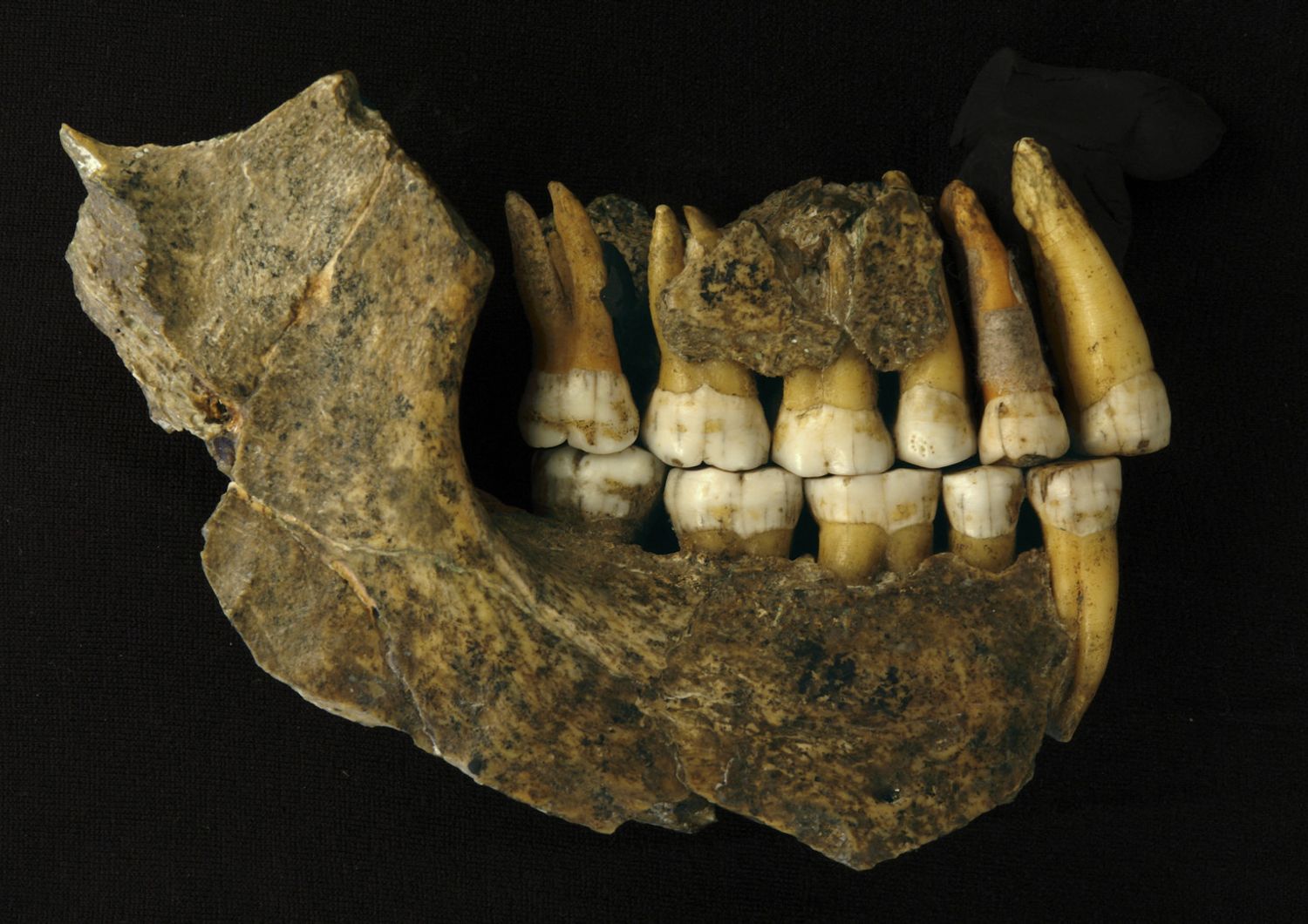 Denti di un Neanderthal
