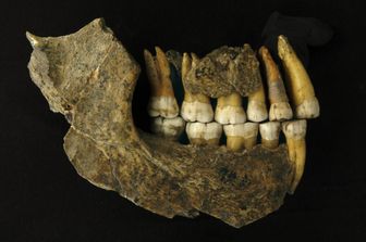 Denti di un Neanderthal