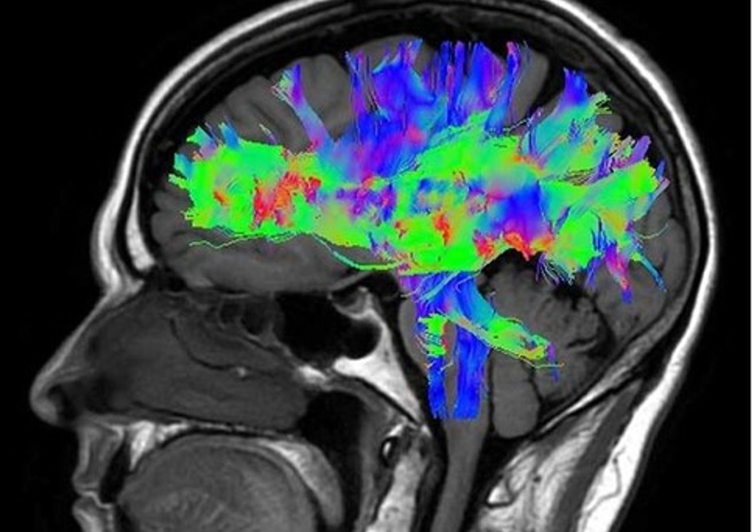 Immagine del cranio con taglio sagittale dell'encefalo