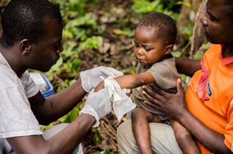 Centrafrica: un bambino malato di vaiolo delle scimmie