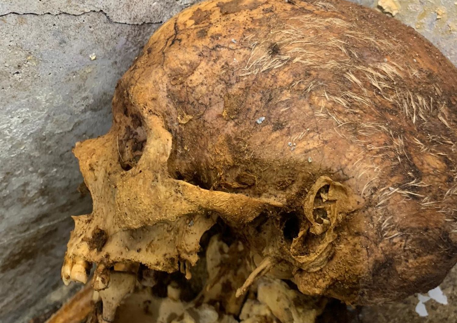 Il cranio di Marcus Venerius Secundus