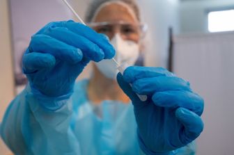 Test per il Covid 19