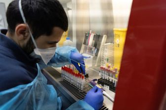Laboratorio analisi test Covid