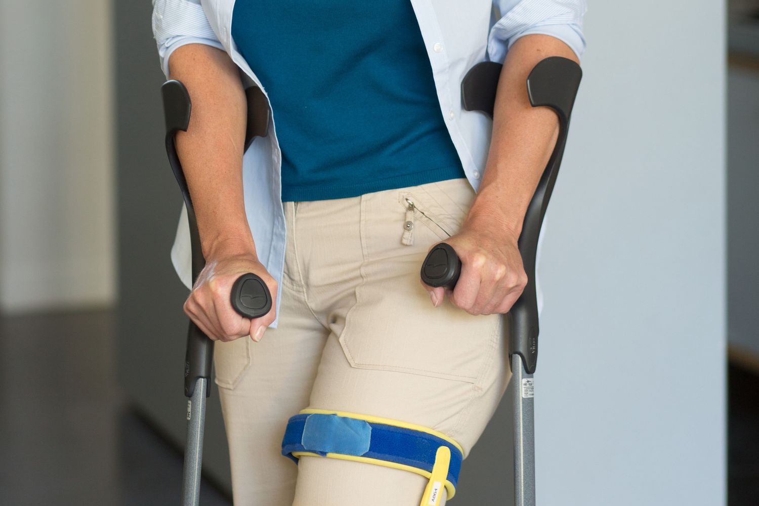 Una donna con le stampelle