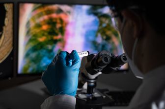 Covid-19 analisi di laboratorio